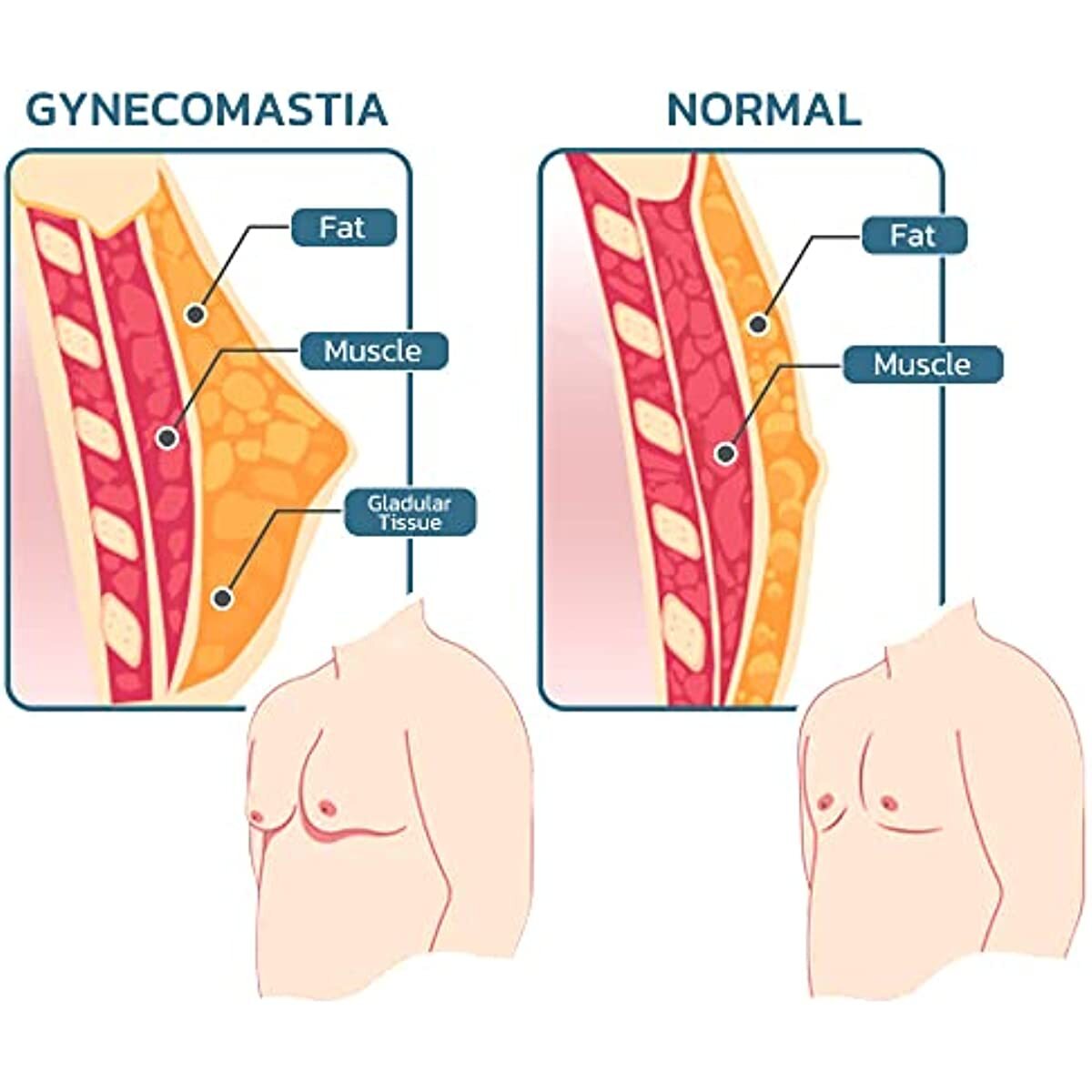 Men Slimming Gynecomastia Chest Belly Compression Body Shaper Tanktop Vest Shirt gallery