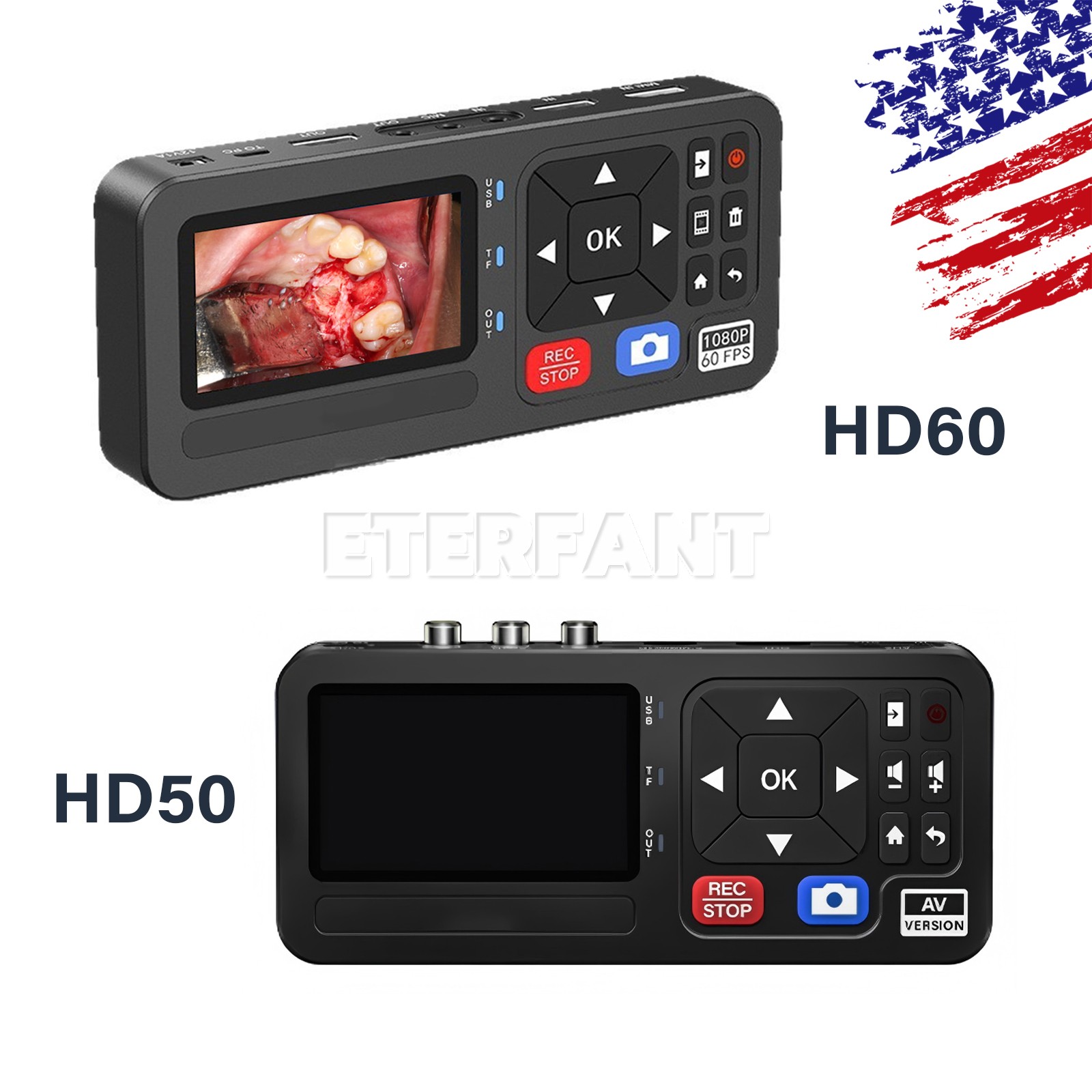 Medical Portable Surgical Recorder for Laparoscopy&Endoscopy Capture HD50/HD60