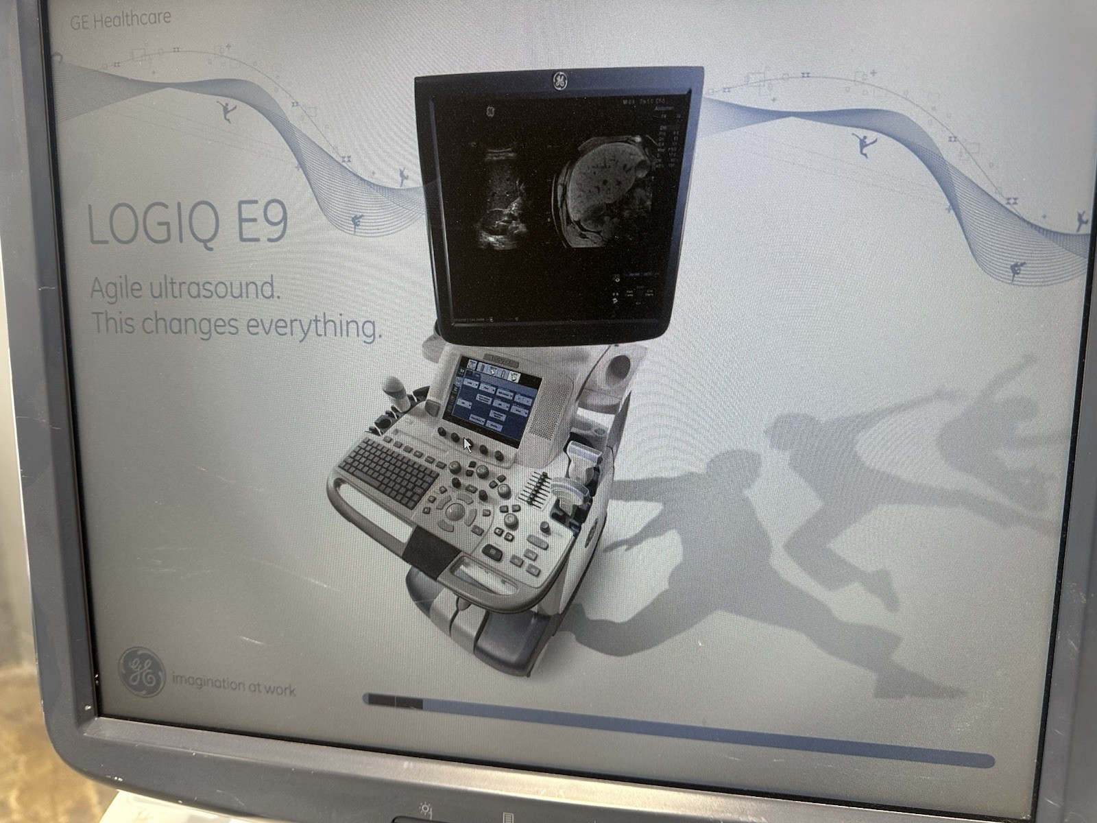 GE Logic E9 Ultrasound With 3 Probes