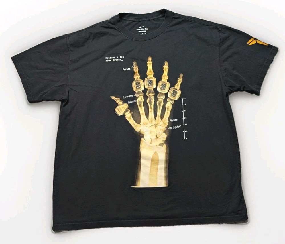 Nike Kobe Mamba X-Ray Patient 24 Five Rings Mens XL Black Loose Fit