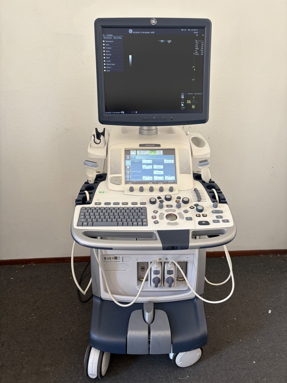 2013 GE Logiq E9 Ultrasound Machine with GE 9L-D & S1-5-D Probes